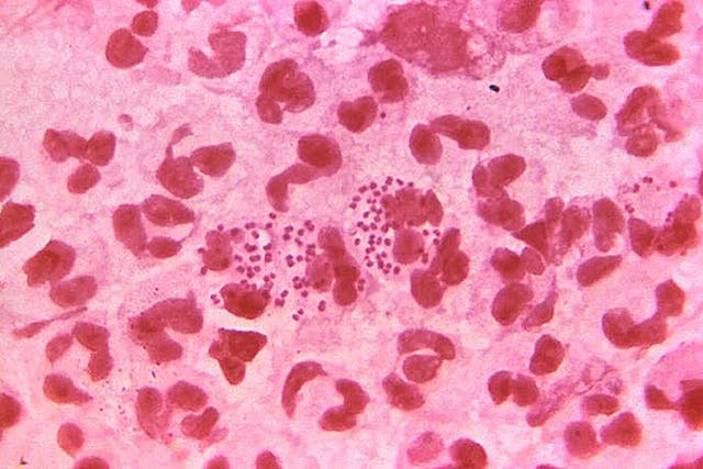 The number of gonorrhoea diagnoses has risen to the highest in any one year since records began in 1918 (CDC/PA)