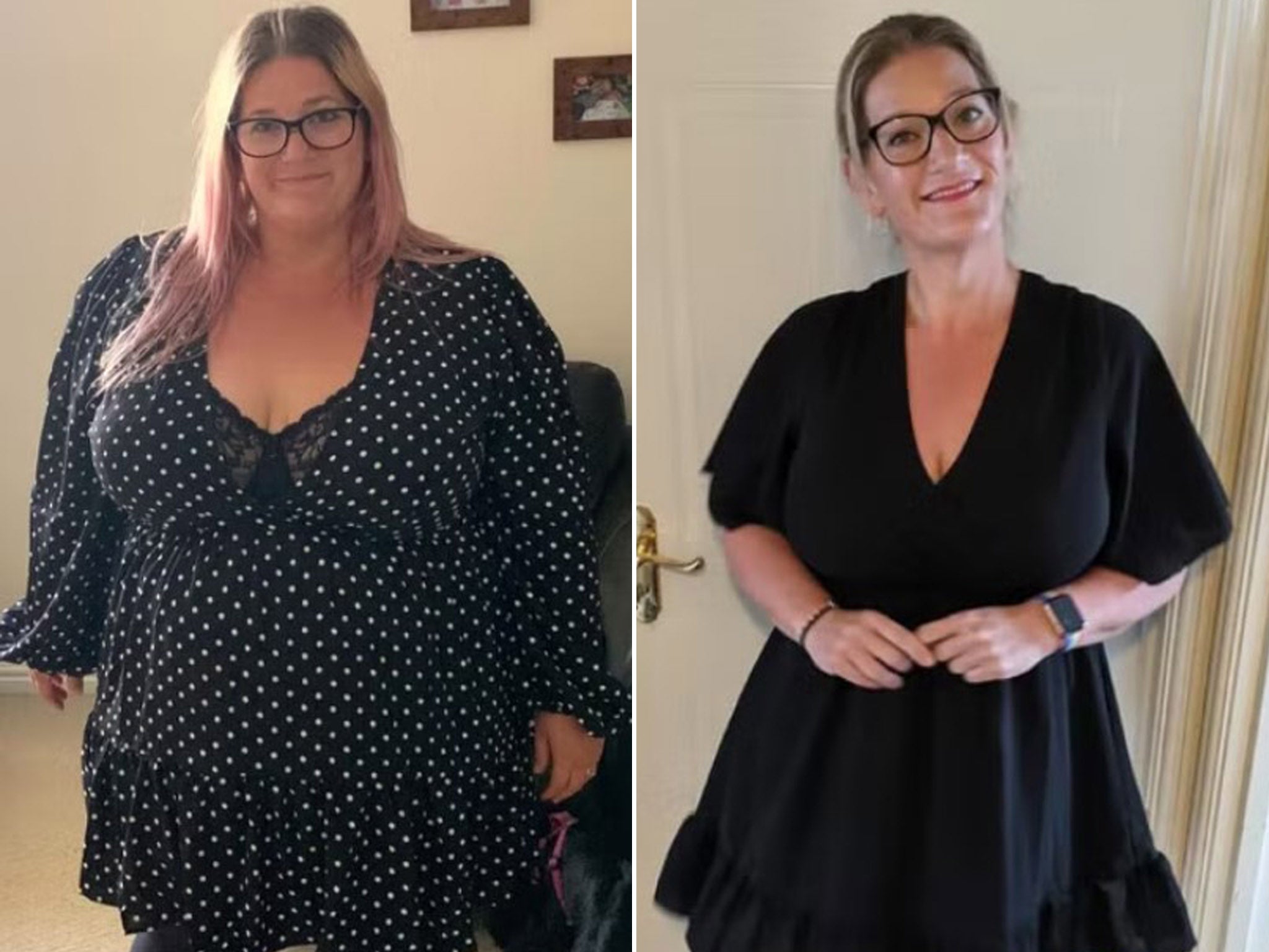 <p>I had bariatric surgery and it changed my life</p>