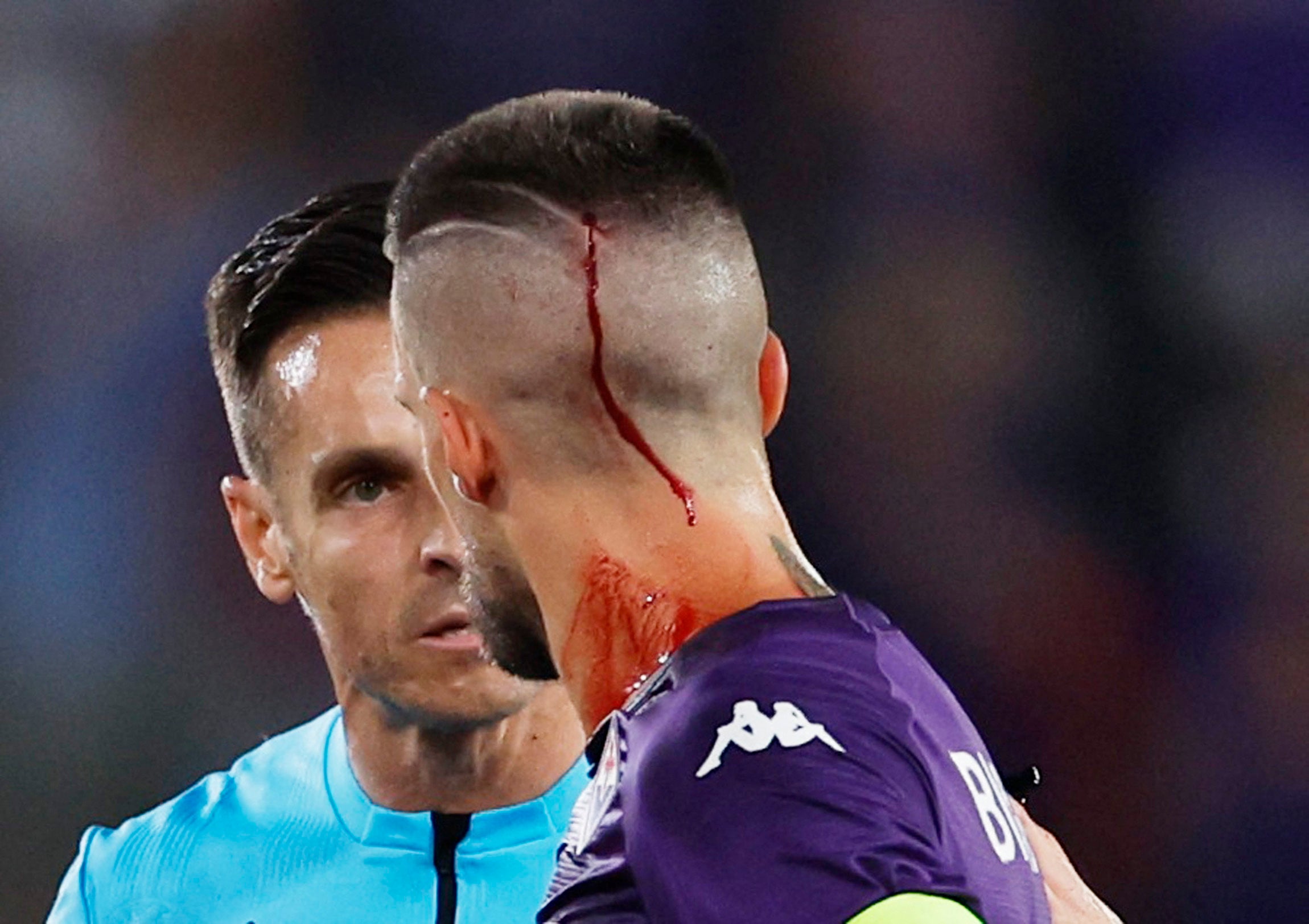 Cristiano Biraghi was left bleeding after being hit by an object thrown by West Ham fans