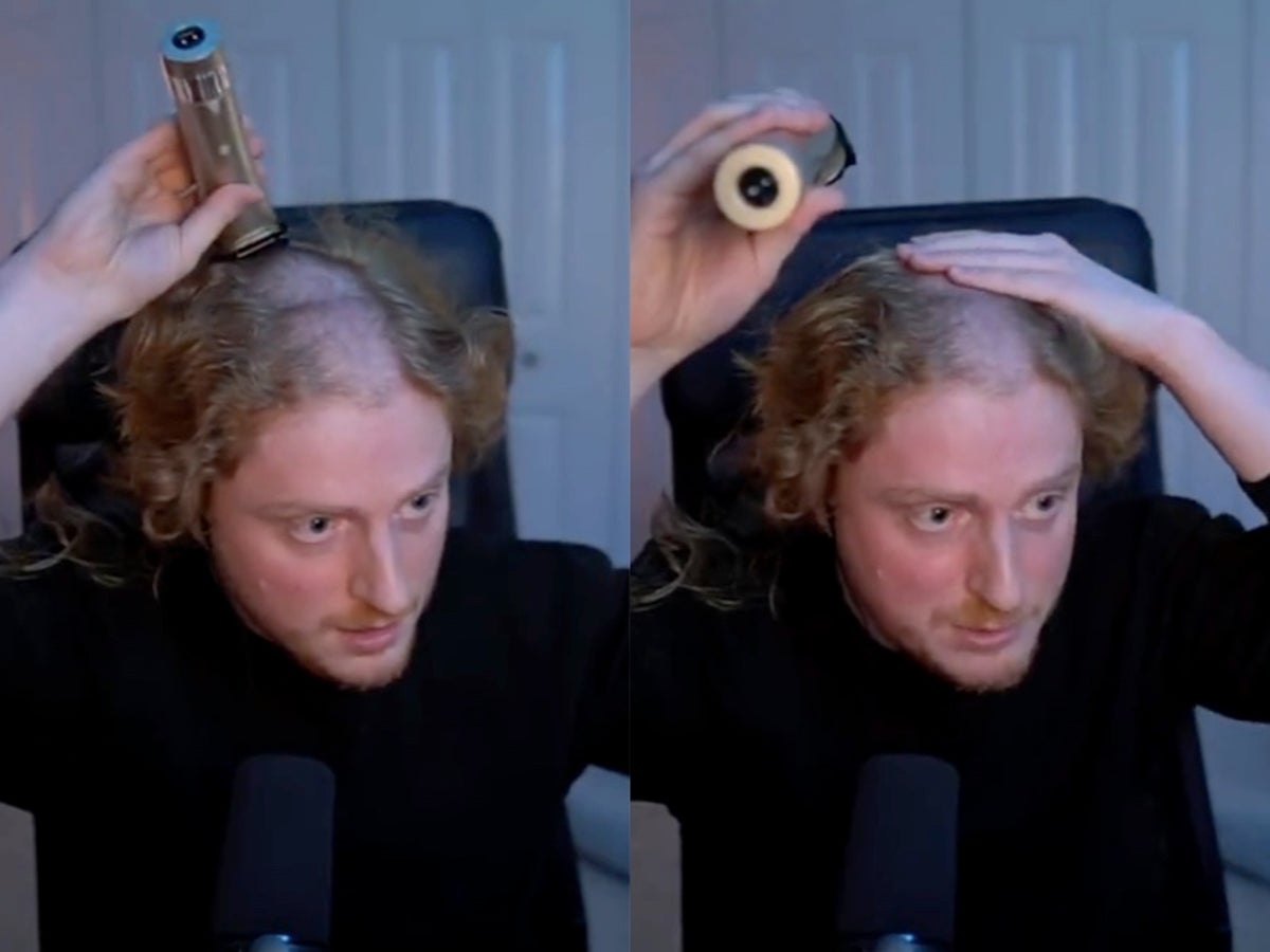 Gamer finds indent in head from prolonged headset use after shaving his hair
