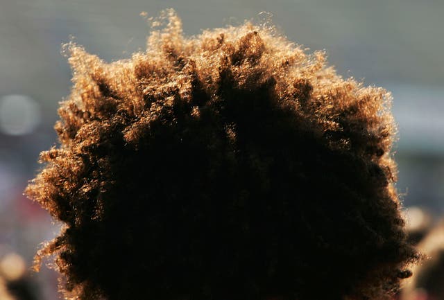 <p>A view of Welsh player Colin Charvis’s hair after the match against the US in an International test match on June 4, 2005 at Rentschler Field in Hartford, Connecticut</p>