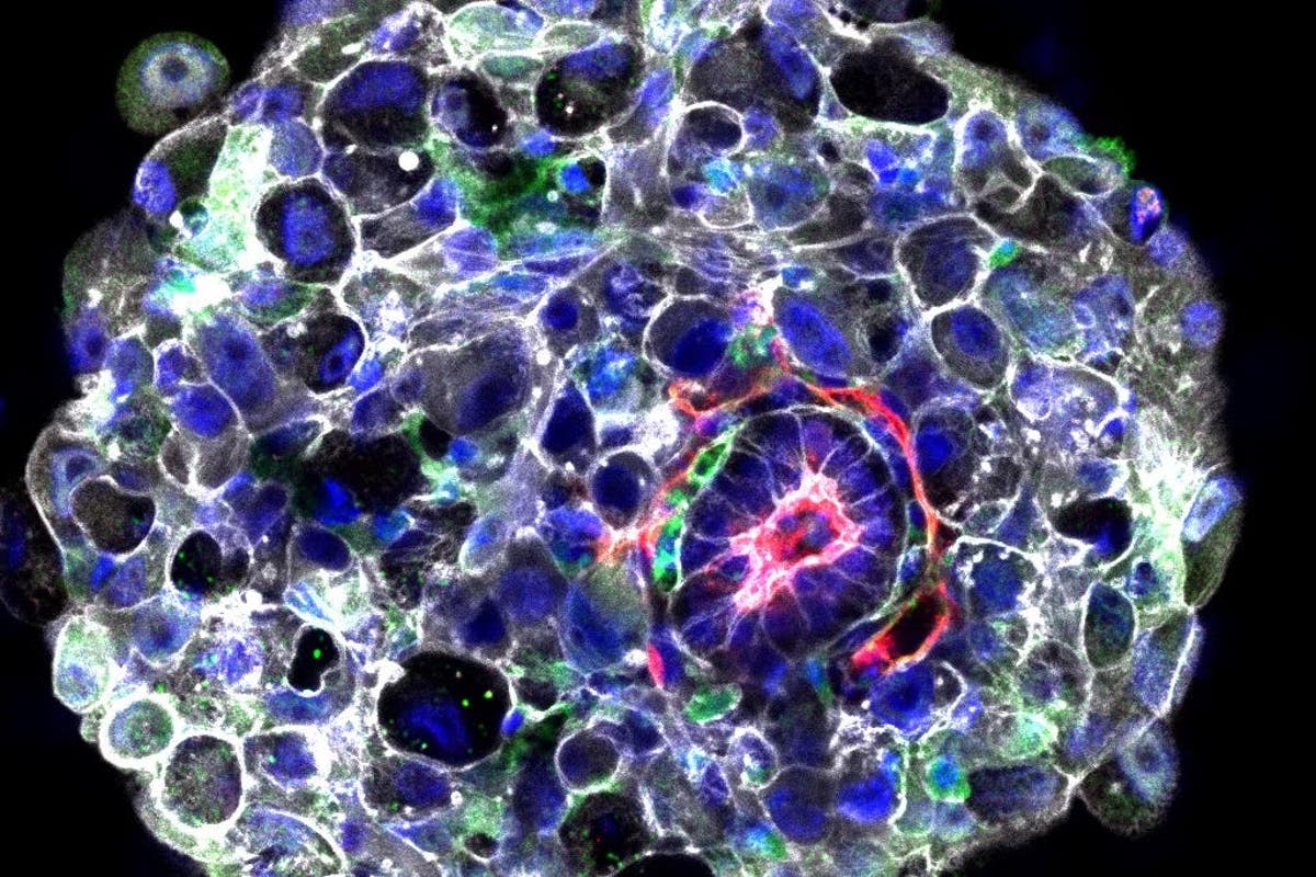 Scientists Develop Synthetic Human Embryos, Bypassing the Requirement for Egg or Sperm