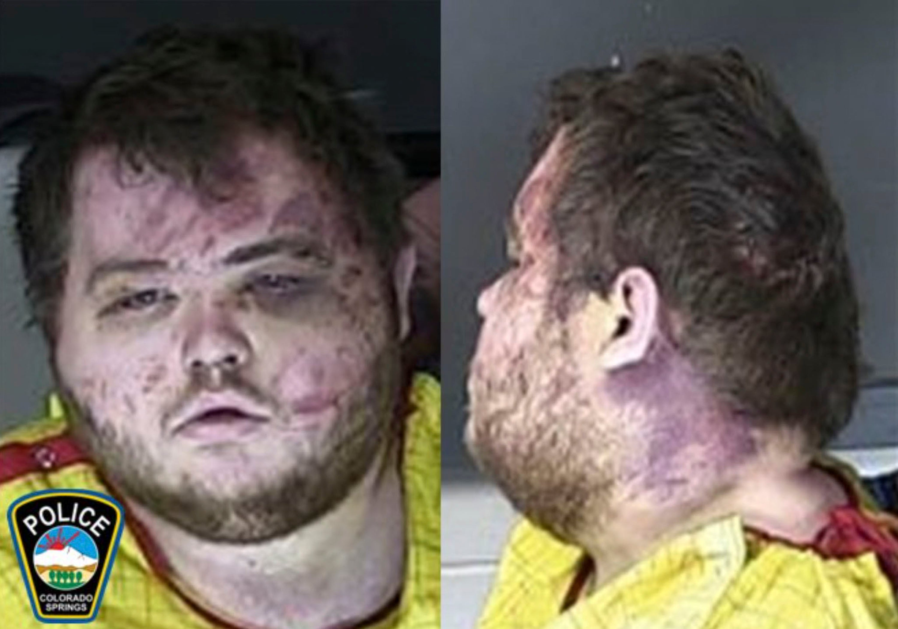 FILE - This booking photo provided by the Colorado Springs, Colo., Police Department shows Anderson Lee Aldrich. (Colorado Springs Police Department via AP, File)