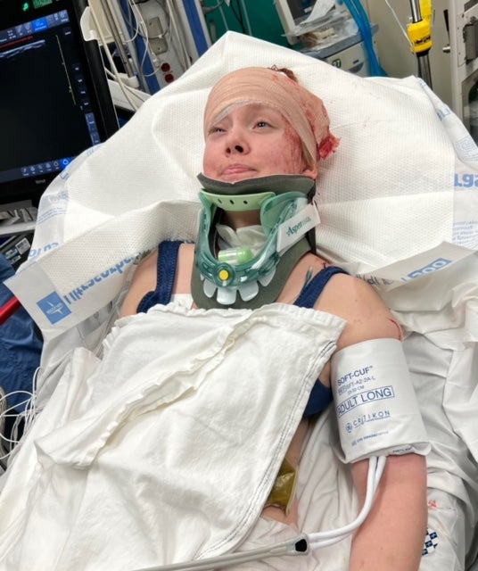 Caitlin is pictured in the hospital after suffering a fall and brain bleed in February, just days after she and her family moved into their new, specially-outfitted home