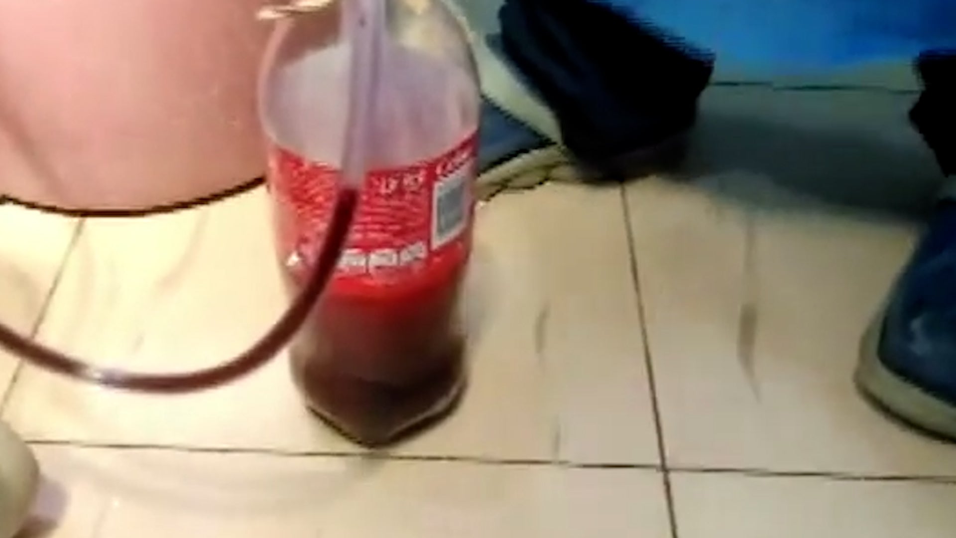 <p>Sudanese doctors save gunshot patient's life using Coke bottle amid conflict</p>