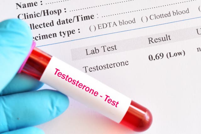 <p>‘I also got it done because I was interested in – apologies for the lofty language – “having a conversation” with my testosterone, the way a lot of my peers currently do’</p>