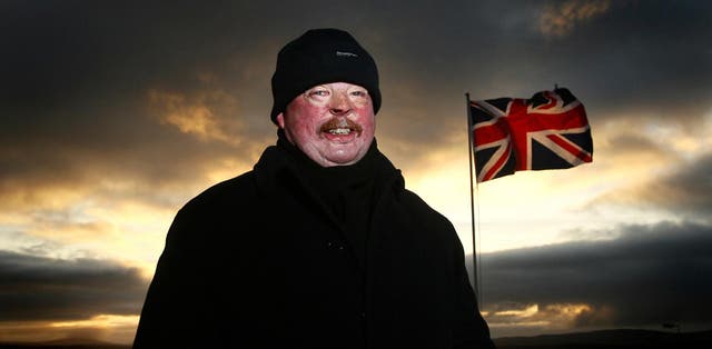 <p>Simon Weston survived the bombing of the ship RFA Sir Galahad</p>