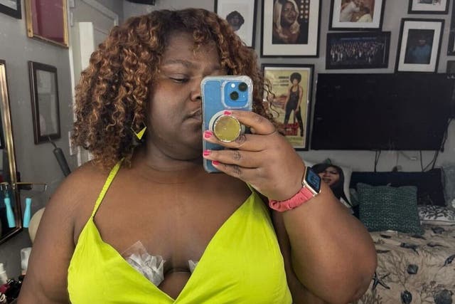 <p>Gabourey Sidibe shared her relatable fashion dilemma involving boob tape on Instagram</p>