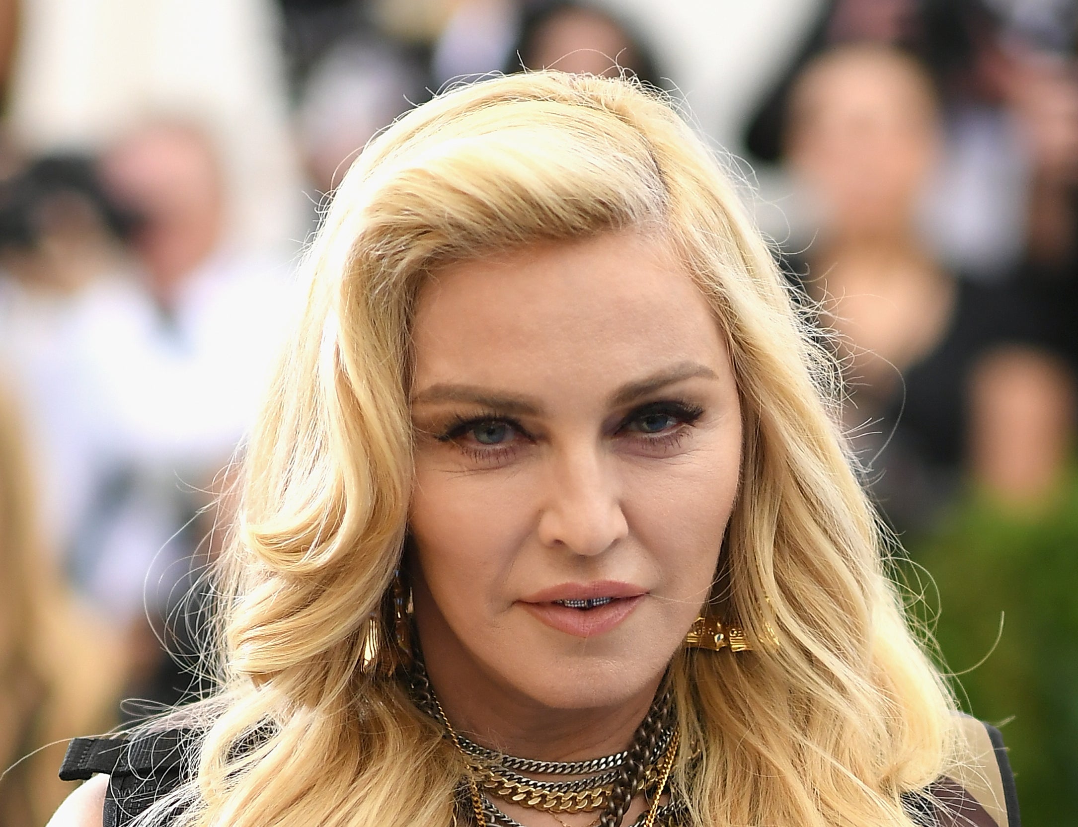 Madonna is still under medical care, her tour manager said