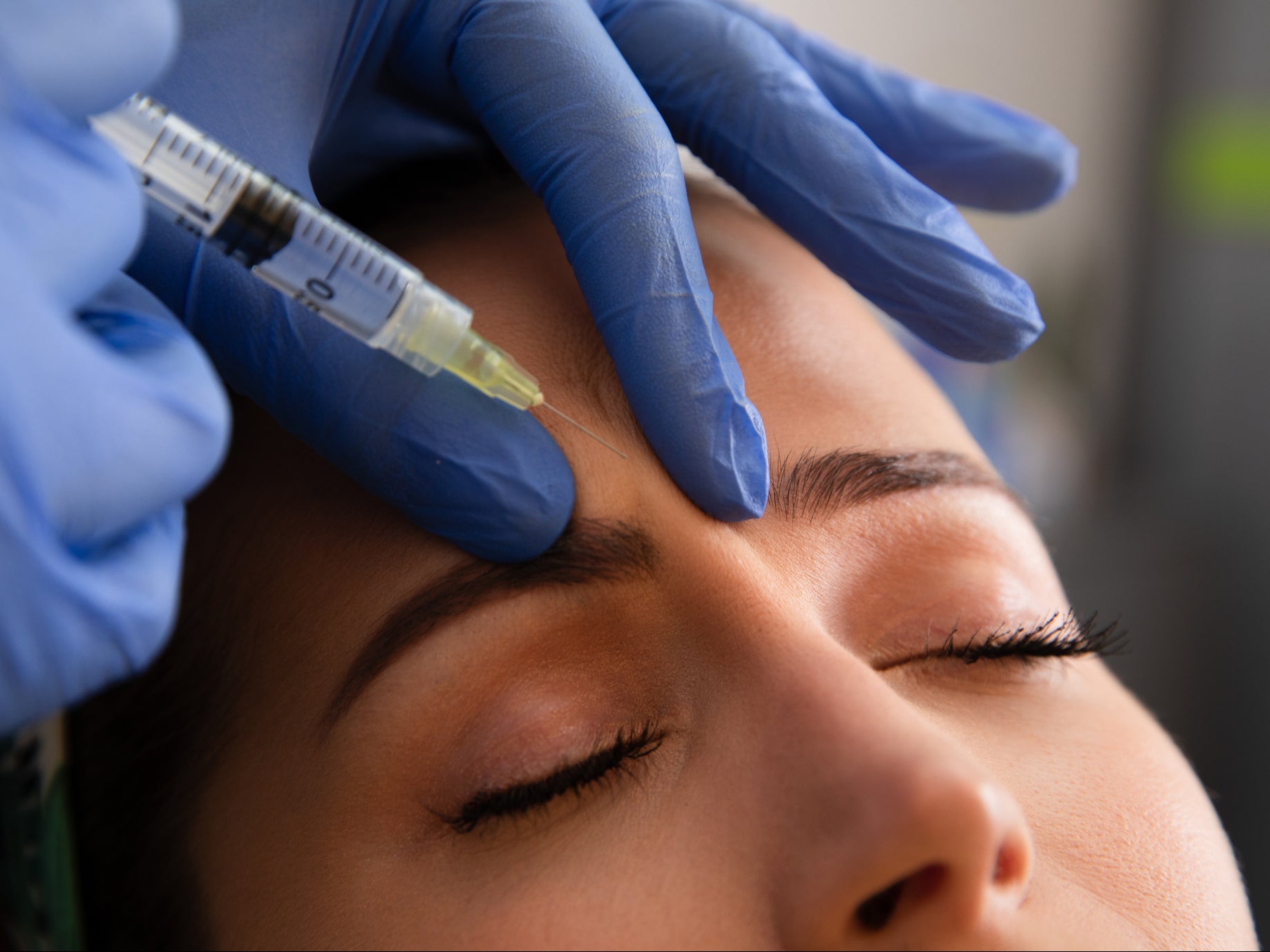 <p>What if I want to do something to my face? Should I feel ashamed if I do? And if everyone else I know is doing it, aren’t I going to start to look a little haggard by comparison?  </p>