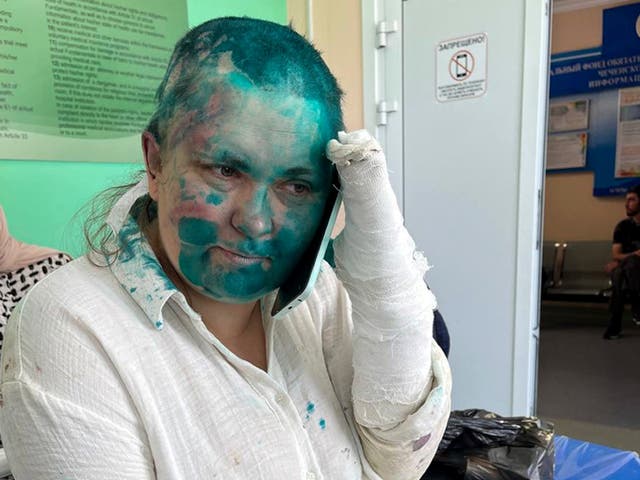 <p>Novaya Gazeta journalist Elena Milashina in hospital after beaing beaten in Grozny</p>