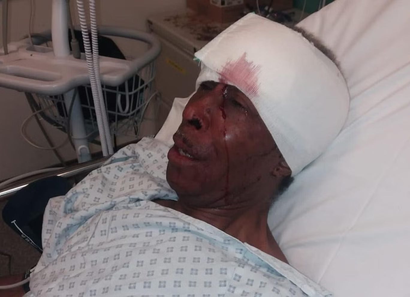 Errol Dixon was hospitalised as a result of injuries suffered during a police stop