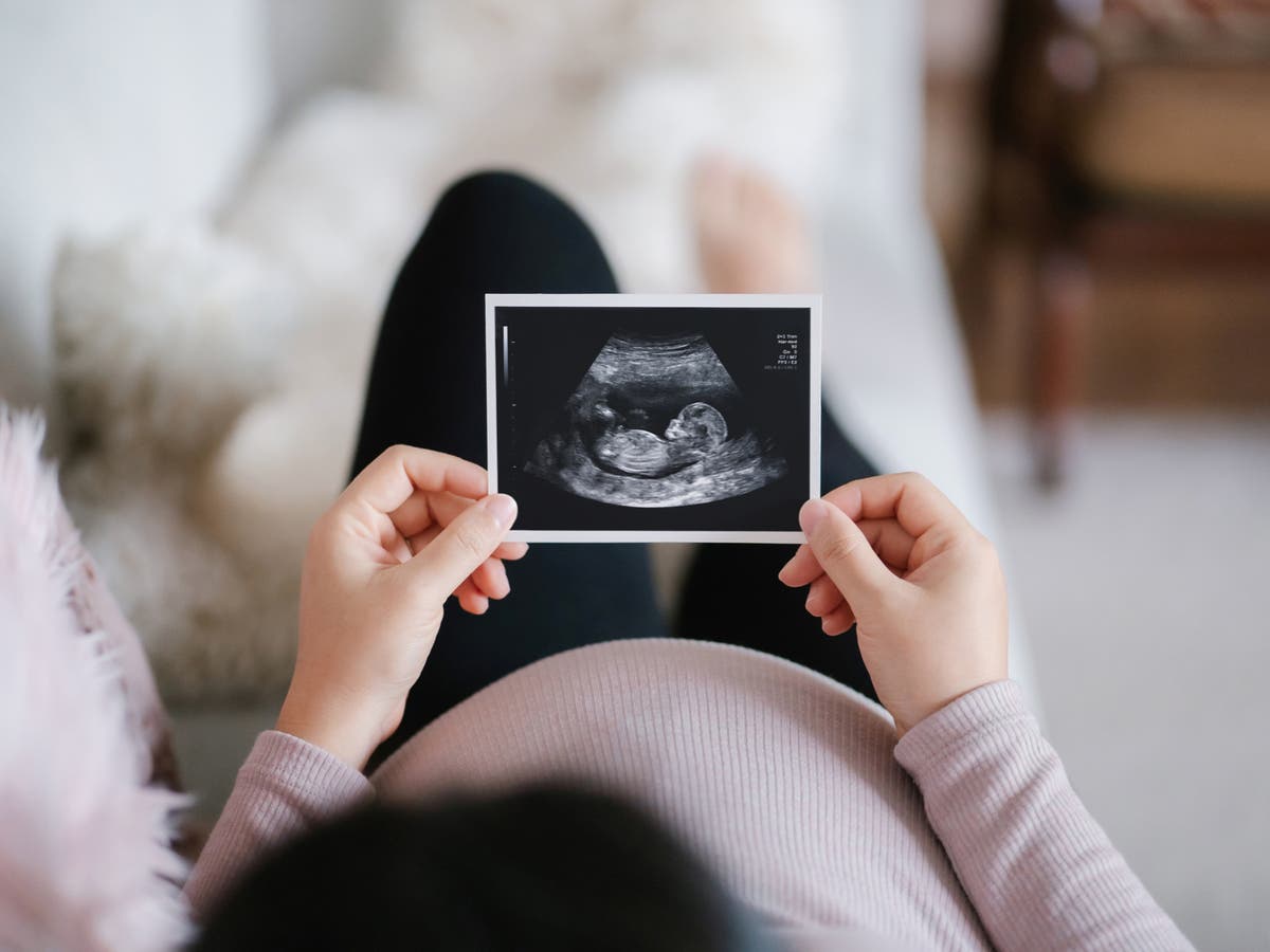 Unborn babies use ‘greedy’ father gene to get more nutrients from mothers, study finds Unborn babies use ‘greedy’ father gene to get more nutrients from mothers, study finds