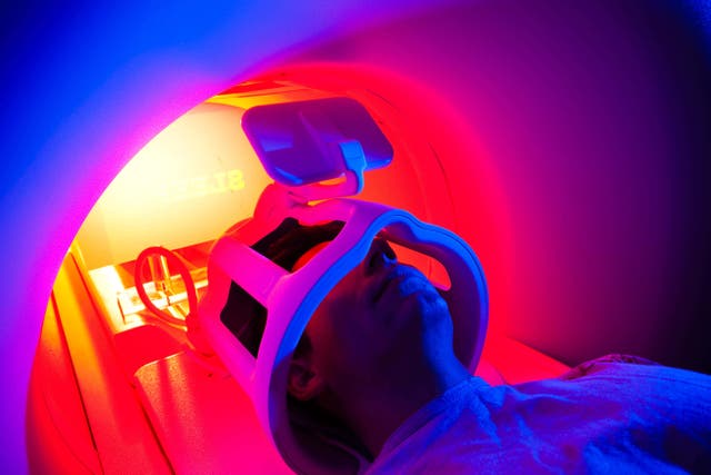 Researchers have said brain scans such as MRIs should be ‘mandatory’ in patients with first-episode psychosis (Alamy/PA)