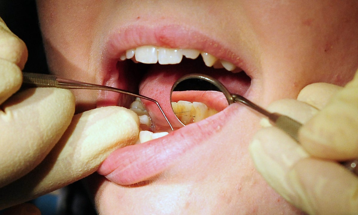 People forced to pull out their own teeth amid NHS dental crisis, report finds