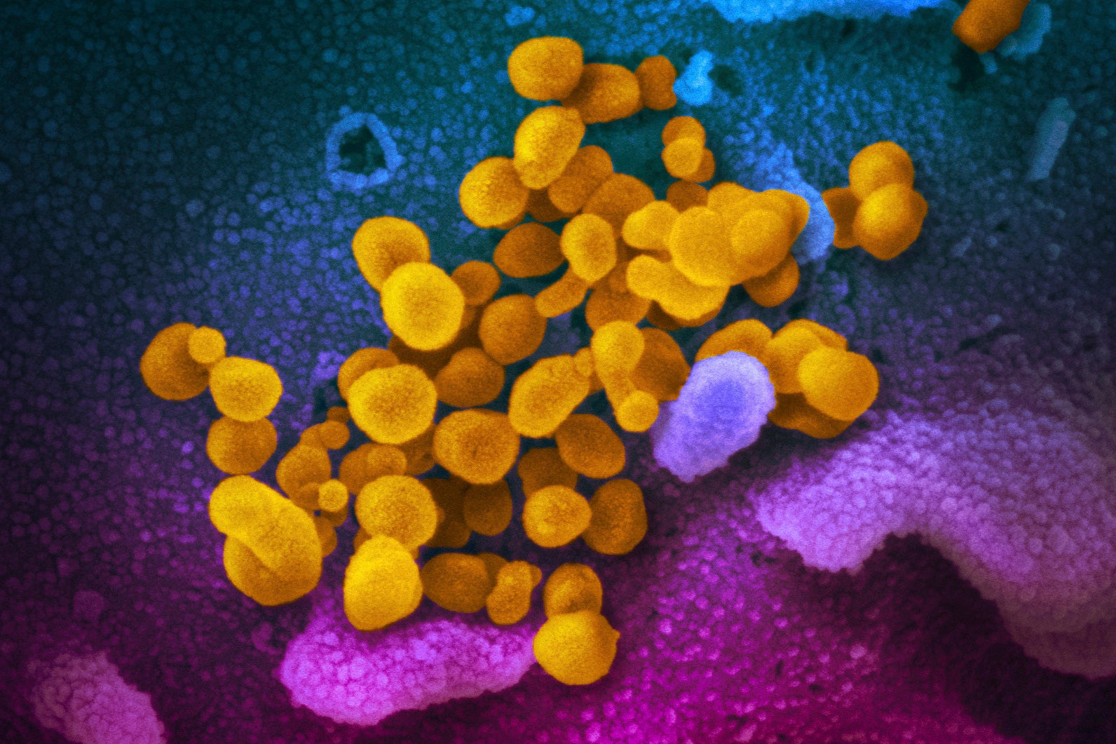 An electron microscope image from the US National Institutes of Health shows the novel coronavirus emerging from the surface of cells