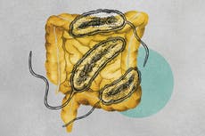 As climate change leads to more and wetter storms, cholera cases are on the rise