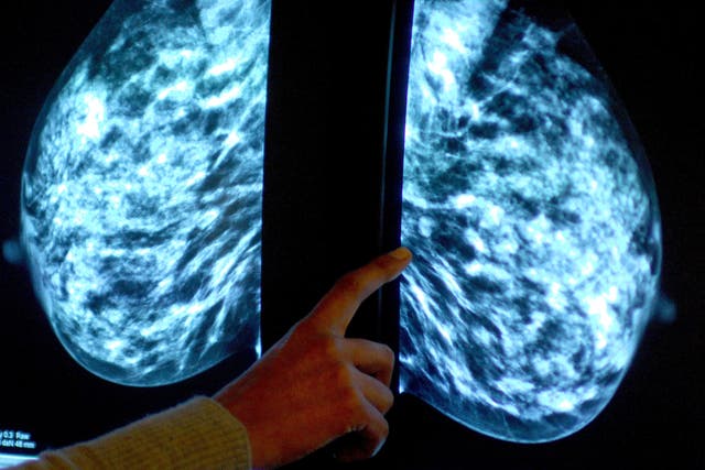 <p>A mammogram shows a woman's breast being checked for breast cancer at Derby City Hospital</p>