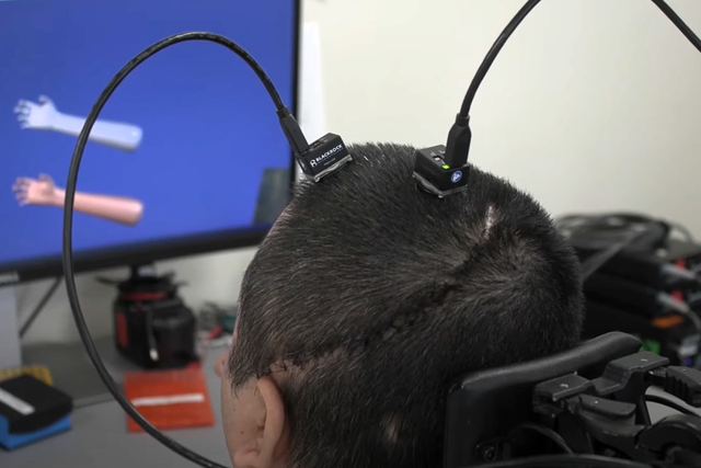 <p>Researchers restored the sense of touch and movement for Keith Thomas using brain implants, artificial intelligence and novel stimulation technology</p>