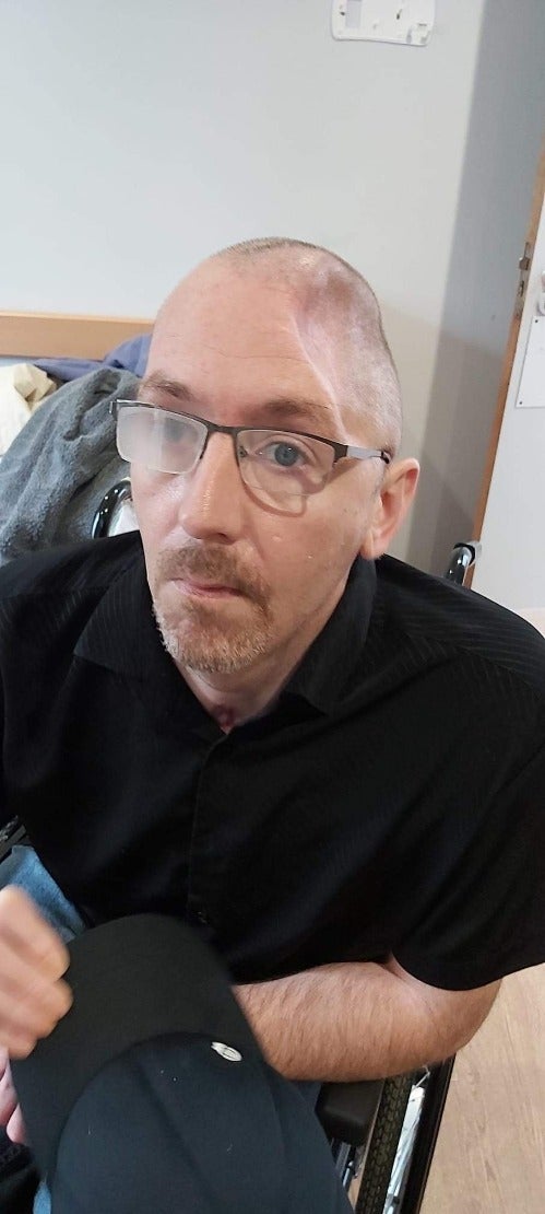 ‘One punch destroyed my son’s life’: Mother’s agony after man left with half a skull