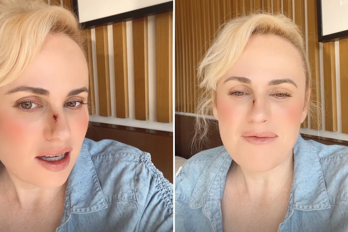 Rebel Wilson details on-set &lsquo;stunt accident&rsquo; that left her with facial stitches