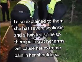 The mother wrote that she warned police not to pull at her daughter’s arms