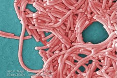 Legionella bacteria can cause serious lung disease that is fatal in 10% of cases