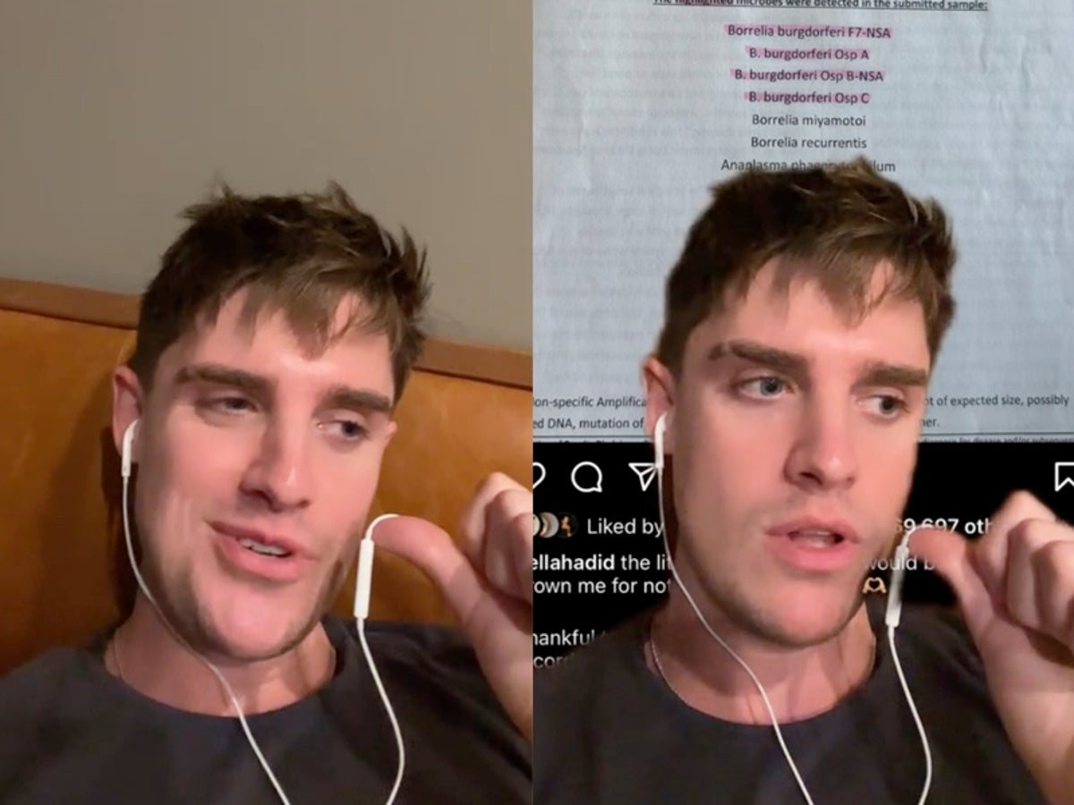 TikTok star Kyle Prue shares ongoing struggle with Lyme disease
