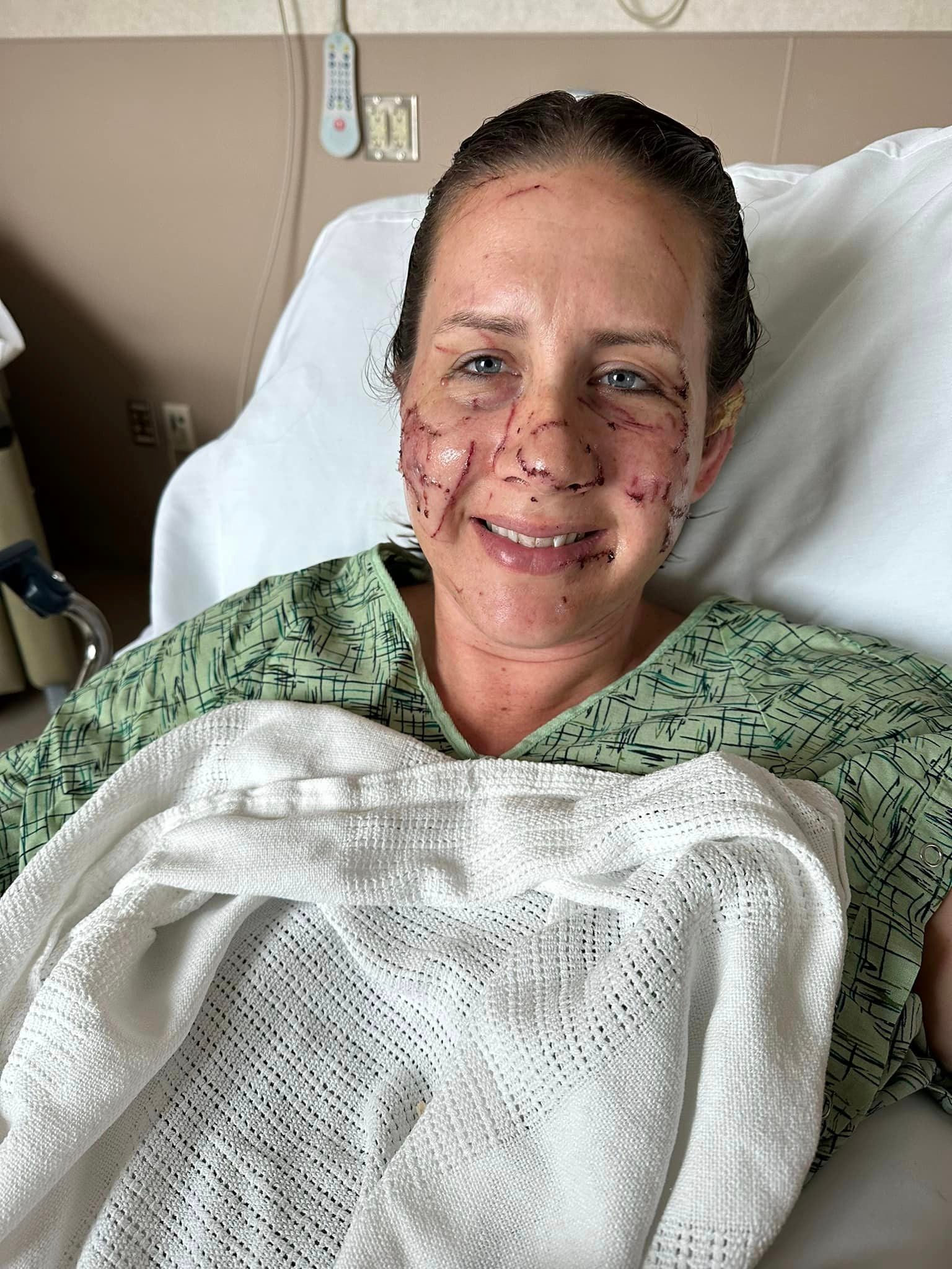 Jen Royce in the hospital after the otter attack