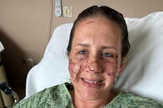 Woman brutally attacked by otter while tubing down Montana river