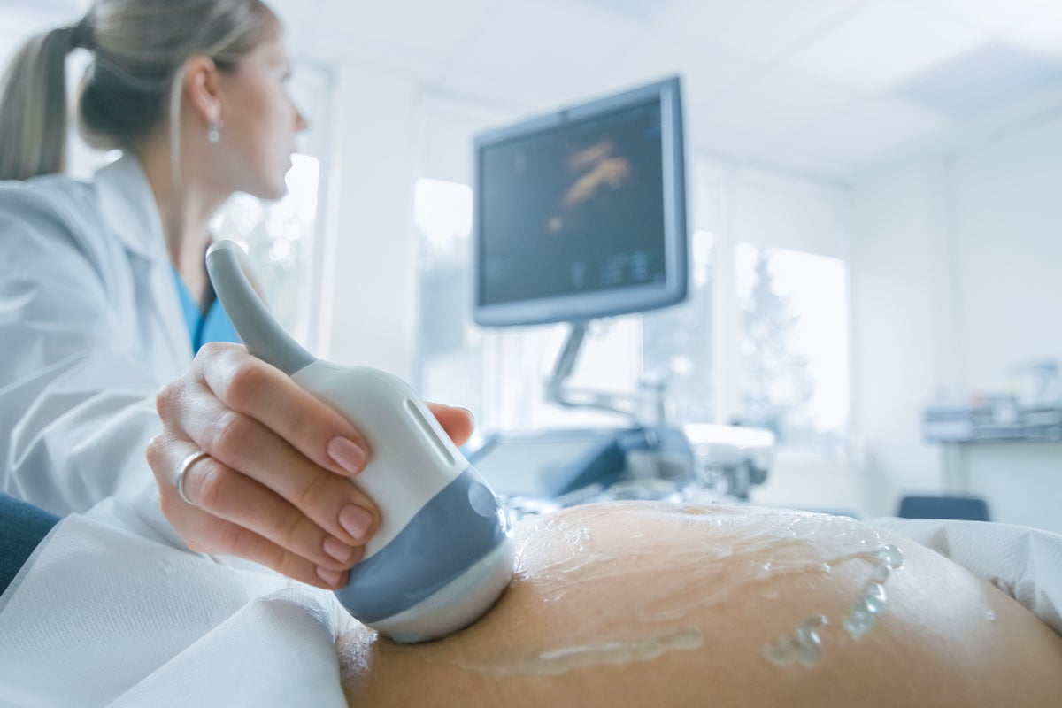 Groundbreaking study shows AI pregnancy scans better than traditional sonograms
