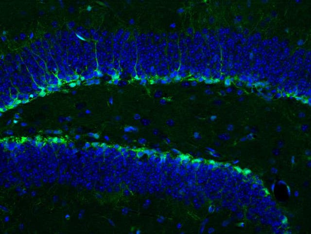 <p>Neural stem cells in a mouse hippocampus shown in green (cell bodies shown in blue) give rise to new mature neurons</p>