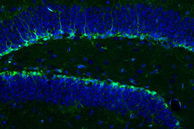 <p>Neural stem cells in a mouse hippocampus shown in green (cell bodies shown in blue) give rise to new mature neurons</p>