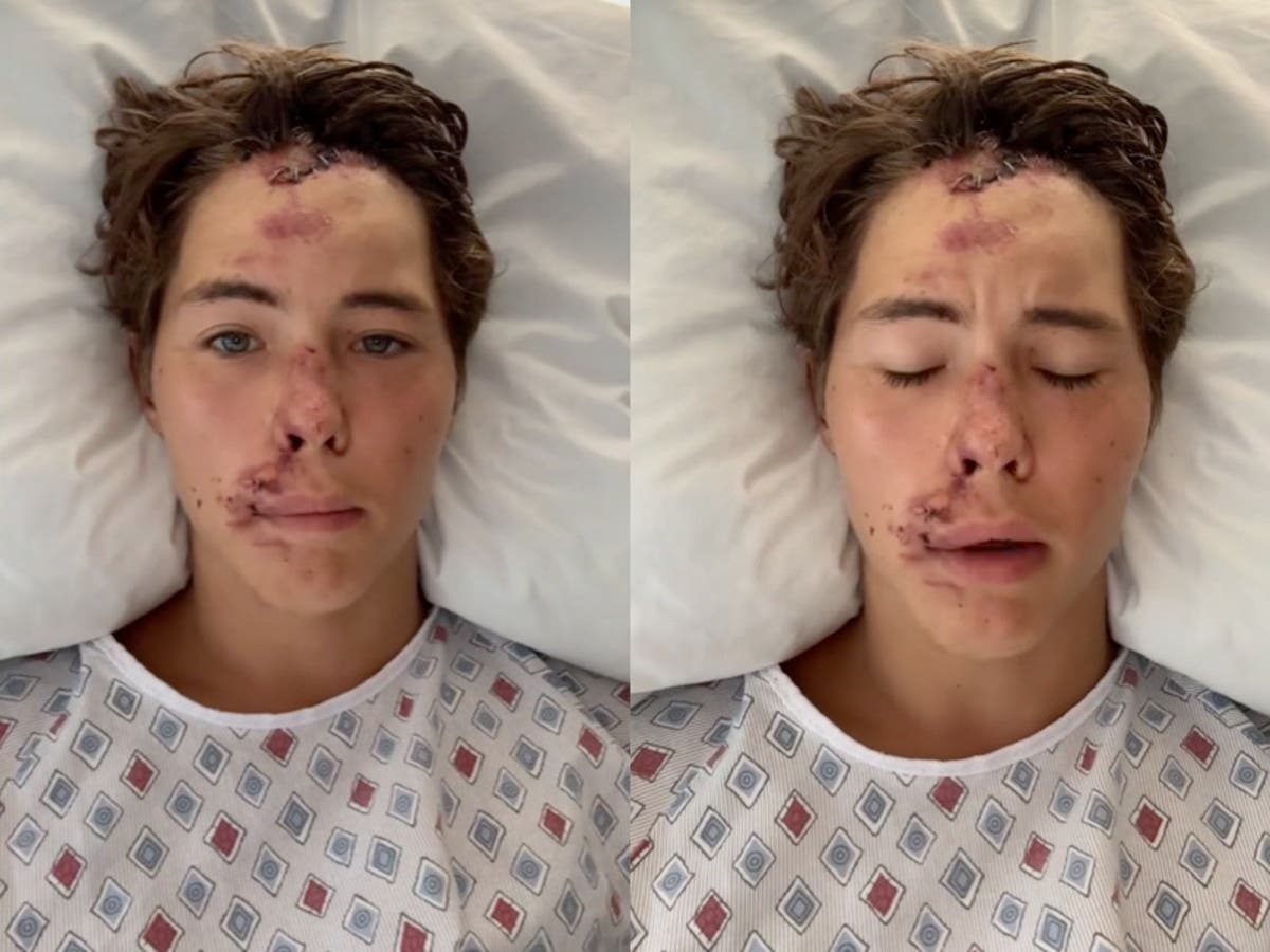 Influencer Caleb Coffee hospitalised with &lsquo;spinal fracture&rsquo; after falling off cliff in Hawaii