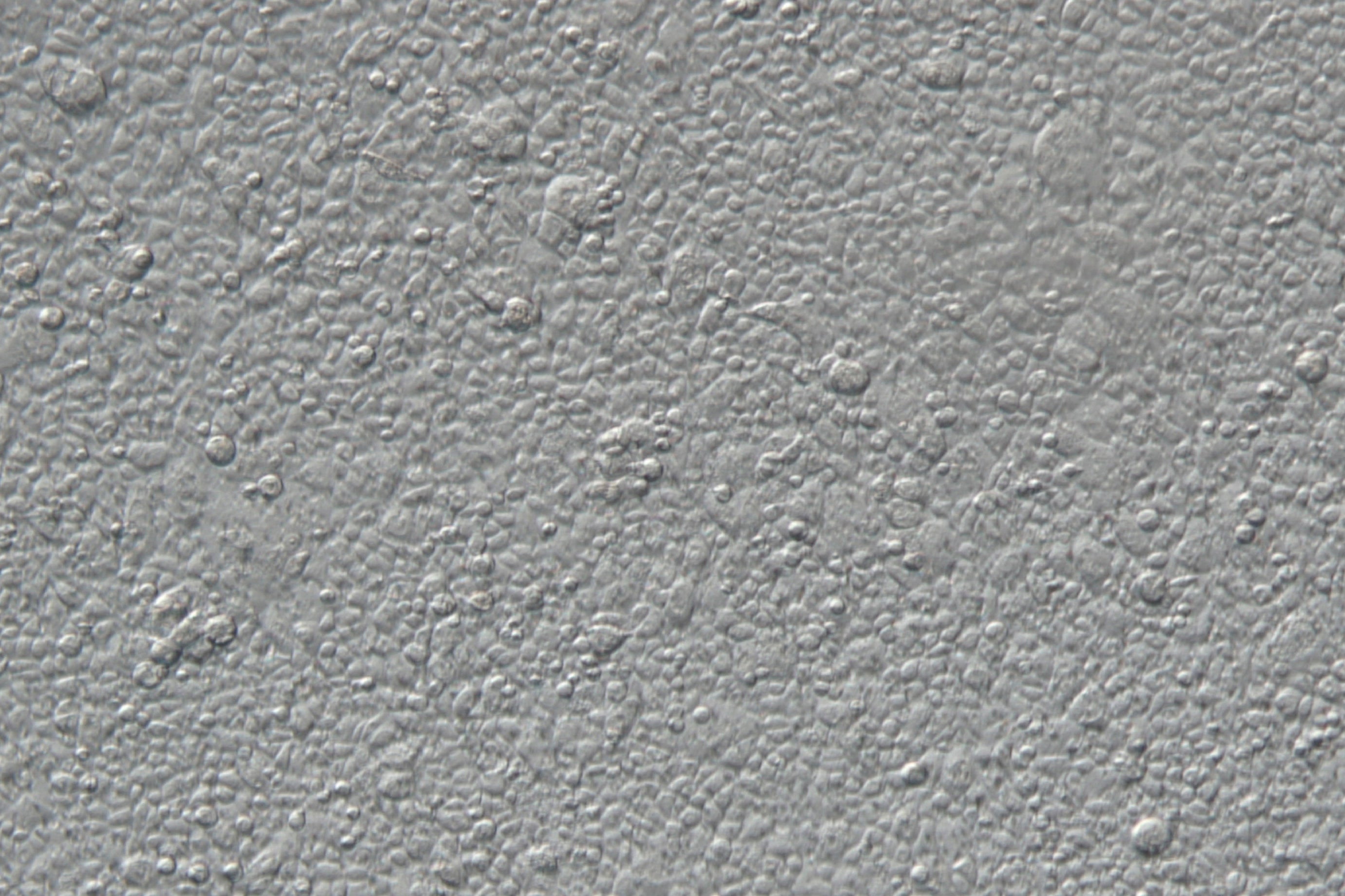 Blindness Stem Cell Study