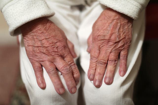 Osteoarthritis affects 15% of the global population over the age of 30 – study (Yui Mok/PA)