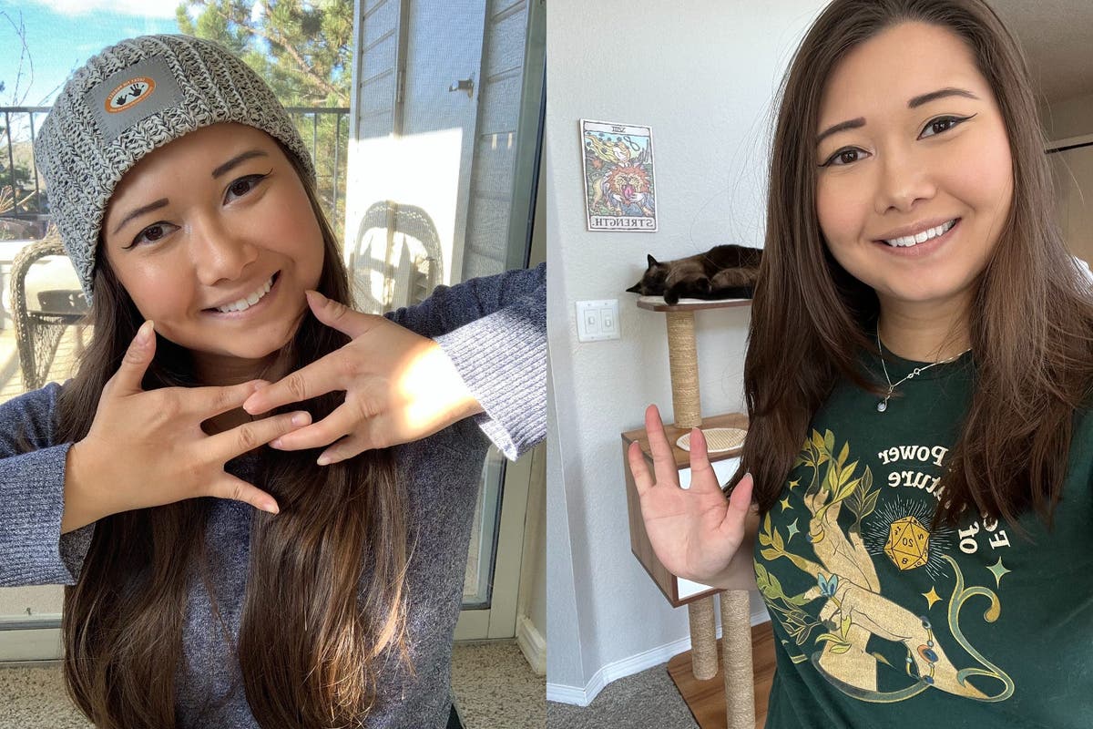 Woman with four digits &lsquo;identified with Mickey Mouse growing up&rsquo; wants to be role model she never had 