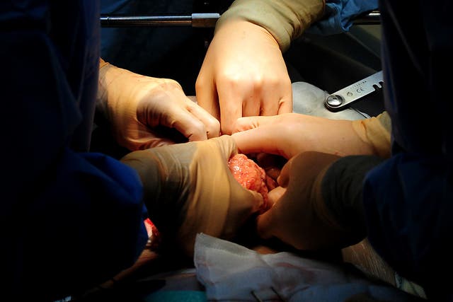 Surgeons have performed the UK’s first womb transplant on a 34-year-old woman (Rui Vieira/PA)