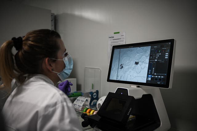 <p>A laboratory employee looks at live cells with an electronic microscope at TreeFrog Therapeutics, a cell therapy biotech company working on treatment research for Parkinson’s disease in Pessac</p>