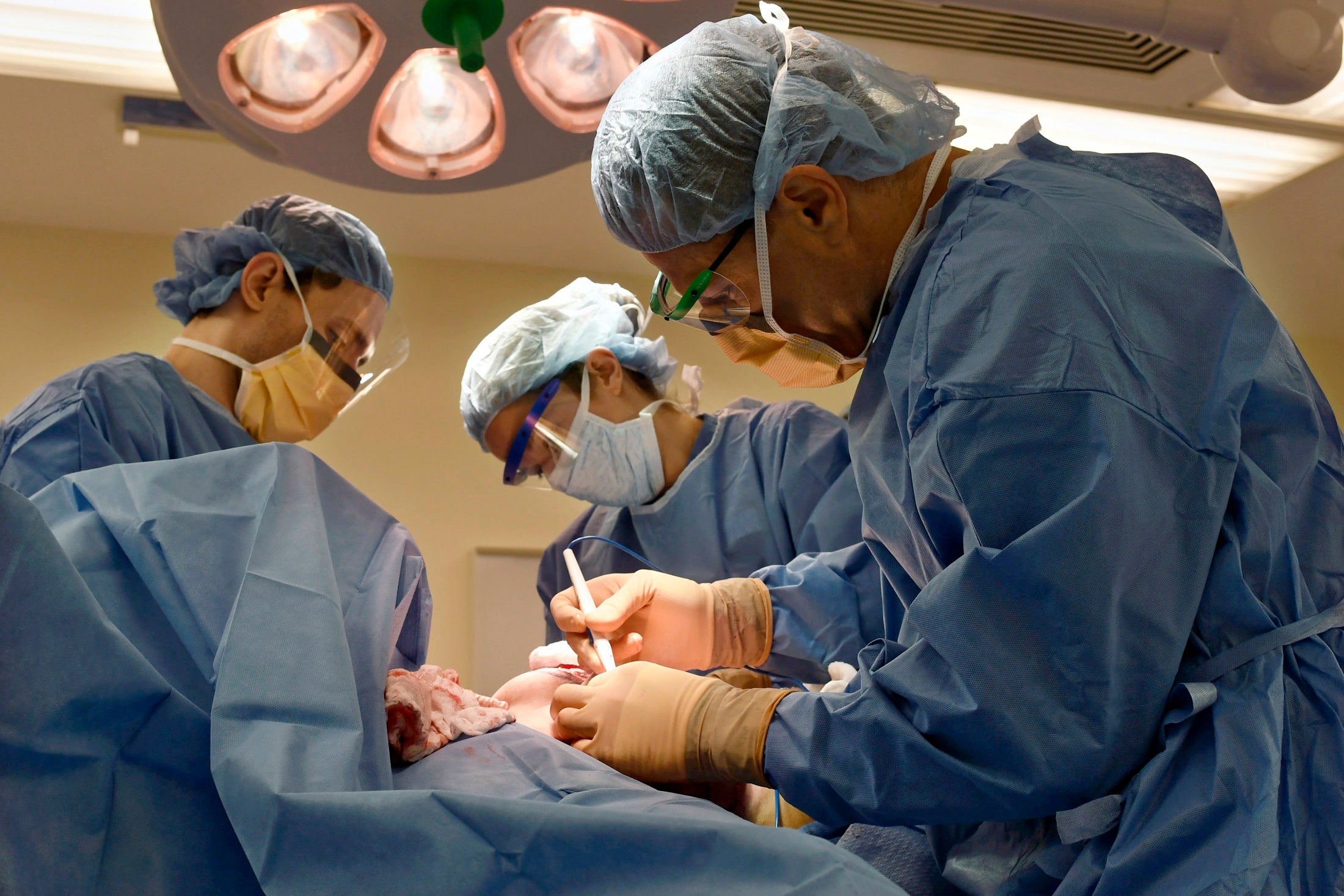 Surgeons perform a bilateral mastectomy on a transgender patient at a hospital in Boston on Friday, July 15, 2016.