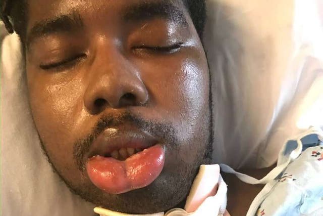 <p>Nathaniel ‘NJ’ Foster after he suffered brain damage while disembarking from a United Airlines flight in 2019</p>