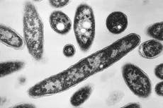One dead and 22 sick from Legionnaires’ cluster in New York, health officials say