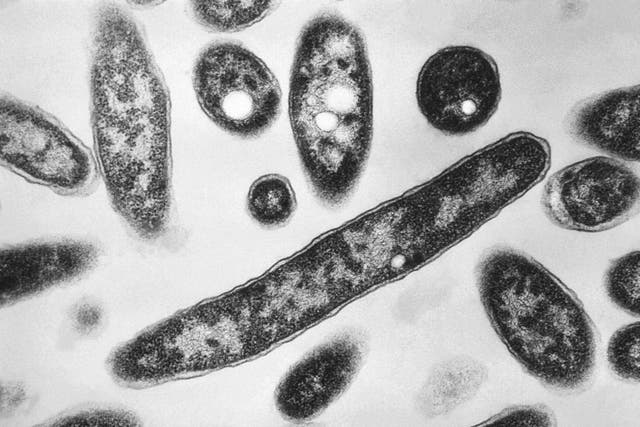 <p>Microscopic bacteria could one day help to solve murders</p>