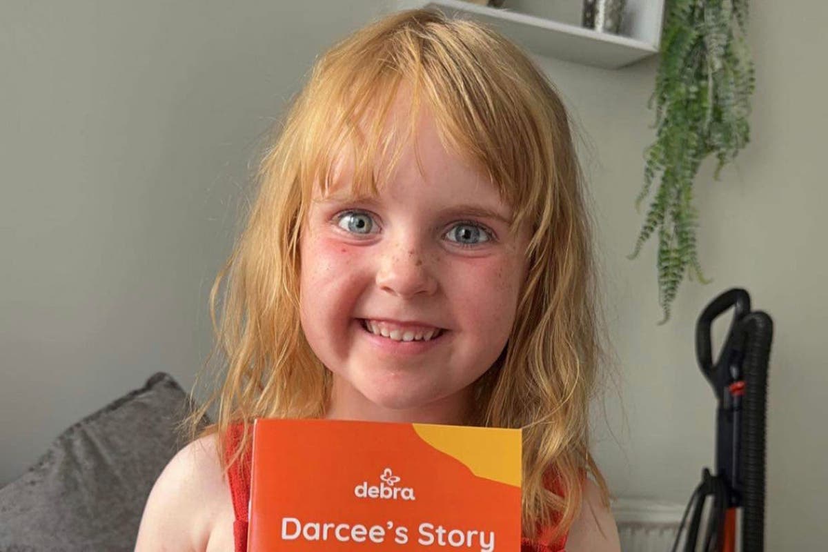 Darcee, 5, is cover star of book explaining her skin condition to