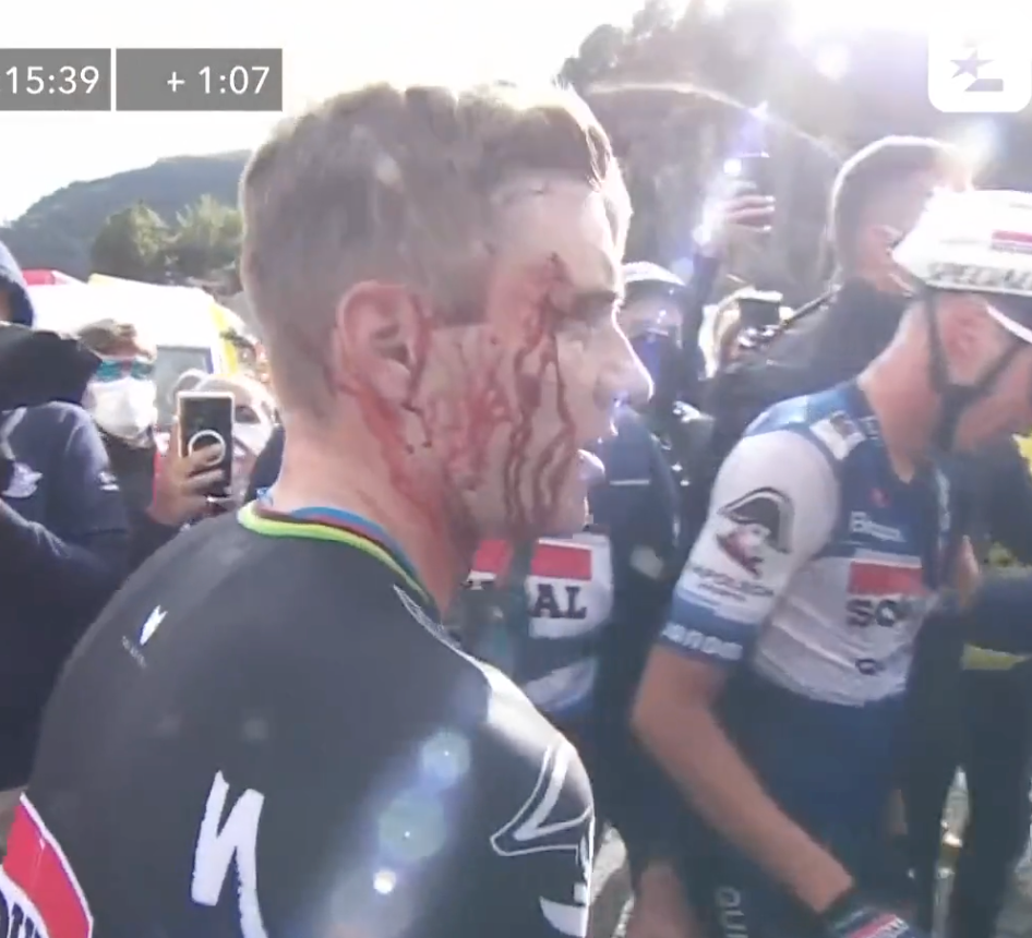 Remco Evenepoel’s face is bloodied following the incident