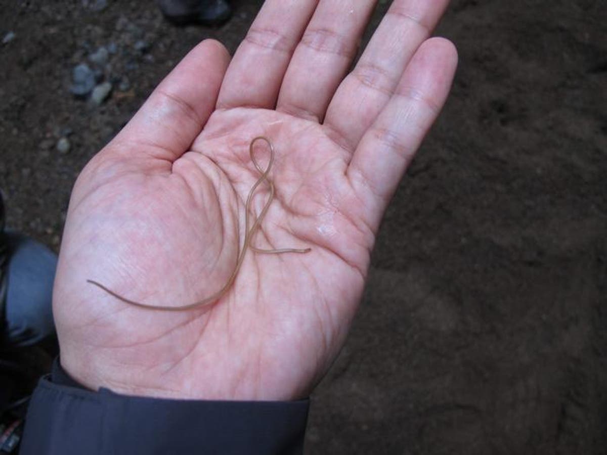 „Živý a svíjející se“ parazitický červ odstraněný z mozku australské ženy