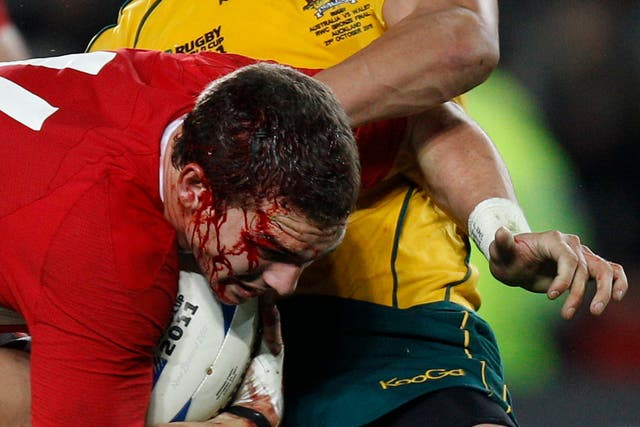 RWC Rugby Head Injuries