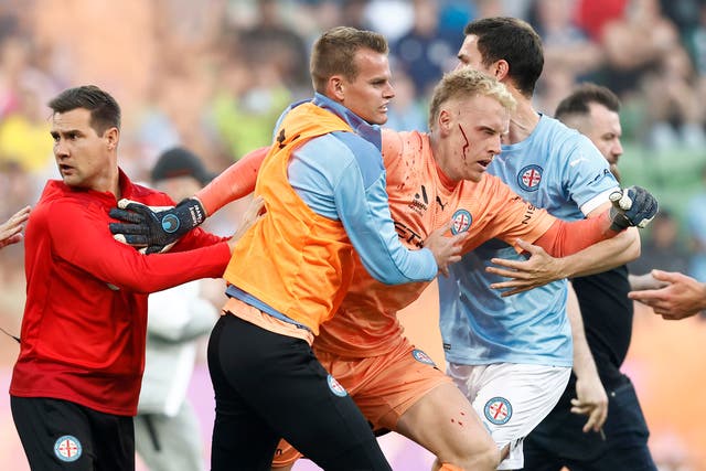 <p>Melbourne City goalkeeper Tom Glover was left with a bloodied face after a pitch invasion during an A-League match last year </p>