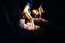 Patients treated by female surgeons ‘less likely to die,’ research finds