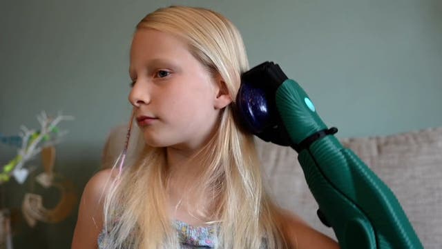 <p>Caitlin Hutson becomes youngest person in UK to be fitted with bionic arm.</p>